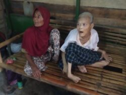 Nurjanah anak yatim yang fisiknya cacat ayah nya meninggal saat masih berudia tujuh tahun