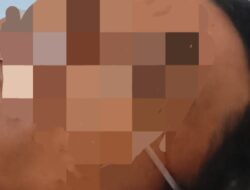 Remaja Tunarungu di Tangerang Tertembak di Mata, Keluarga Desak Polisi Usut Tuntas