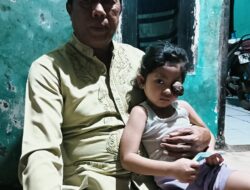 Kades Pagenjahan Sambangi Anak Menderita Penyakit Tumor Mata Berharap Dapat Penangan Khusus Dari Dinas Kesehatan