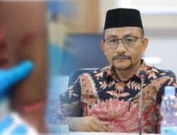 Pemuda Korban Pembacokan di Lhokseumawe Mengadu karena Tak Bisa Berobat tanpa BPJS, Haji Uma Turun Tangan Beri Bantuan Medis