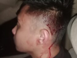 Ketum FWJ Indonesia: Kondisi Zaky Belum Stabil Usai Dikeroyok Oknum Ormas Al Jabar