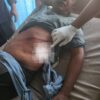 Petani di Bener Meriah Diserang Gajah Liar Saat Menuju Kebun, Alami Luka Serius di Perut