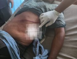 Petani di Bener Meriah Diserang Gajah Liar Saat Menuju Kebun, Alami Luka Serius di Perut