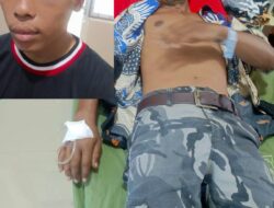Diduga Pengeroyokan di Aceh Timur, Dua Korban Dirawat di RSUD Peureulak